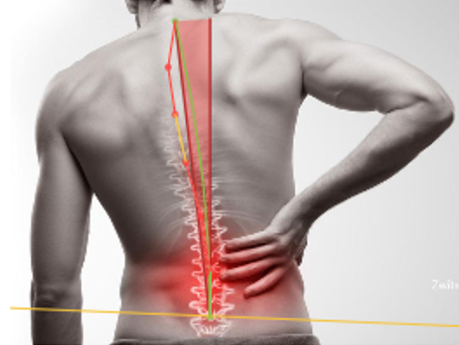 Douleurs lombaire - Soulager le mal de dos avec APORIA