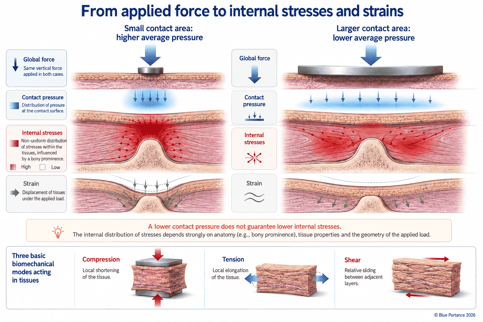Differences between force, interface pressure, internal stresses and tissue deformation.
