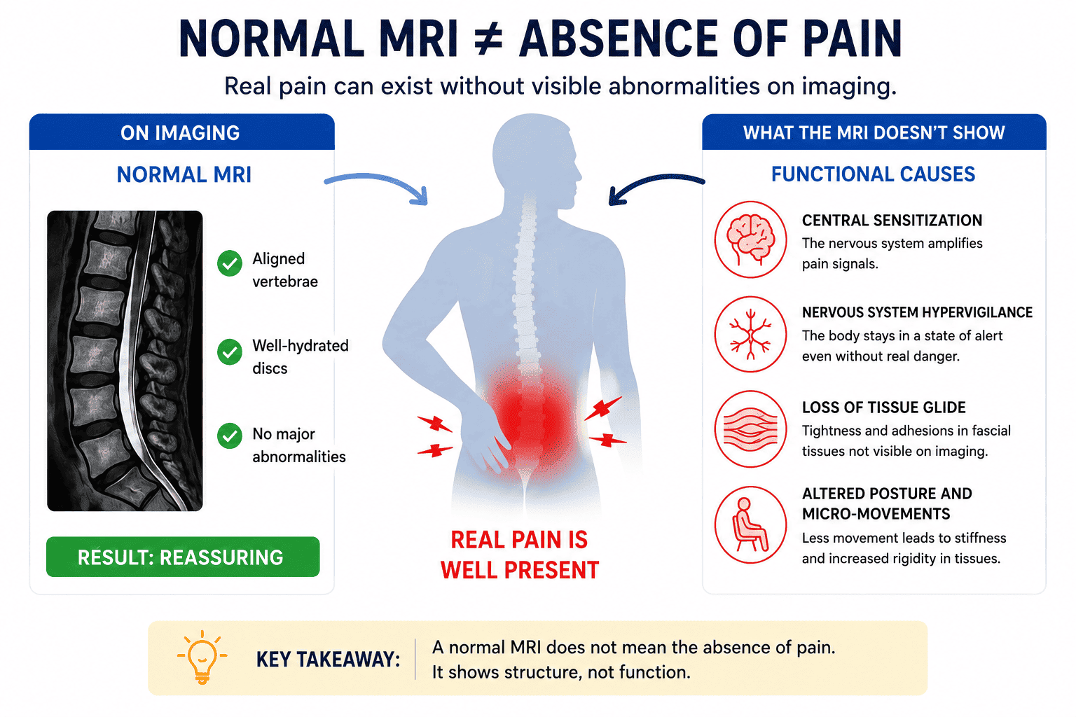 Normal MRI and chronic back pain with invisible pain mechanisms involving the nervous system and fascia