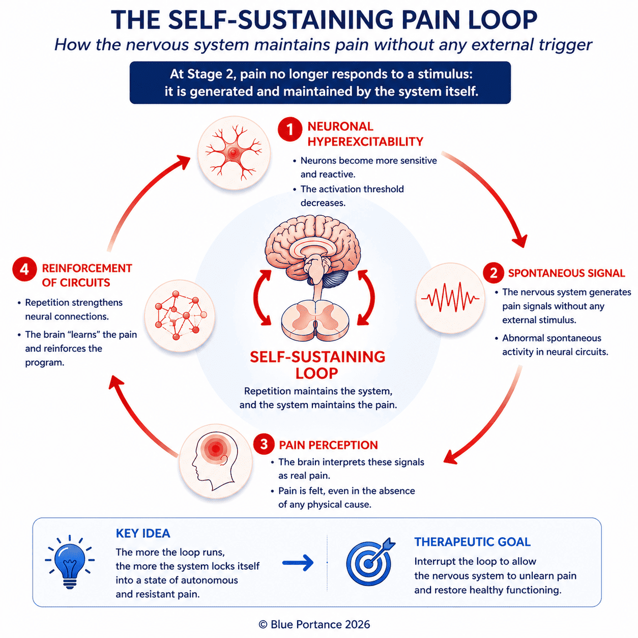 Four-stage neuronal cycle showing how pain is generated and reinforced without any external stimulus: neuronal hyperexcitability, spontaneous signal, pain perception, circuit reinforcement